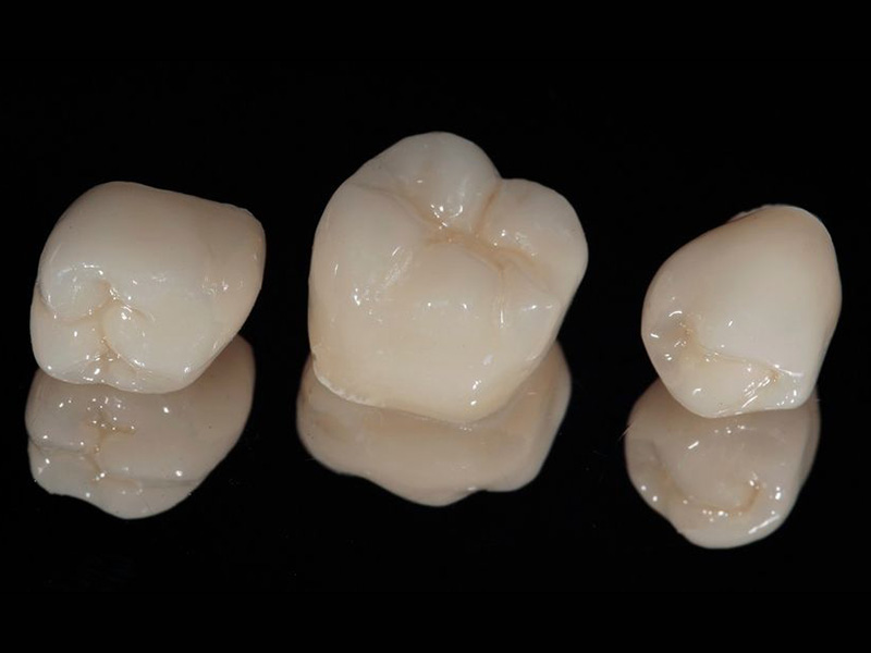Протезирование – вторая жизнь для зуба